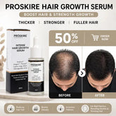 Proskire Hair Growth Serum – Reduces Hair Fall, Boosts Hair Density, Activates Follicles – For Bald Patches, Receding Hairline & Thinning Hair MISO DEALS