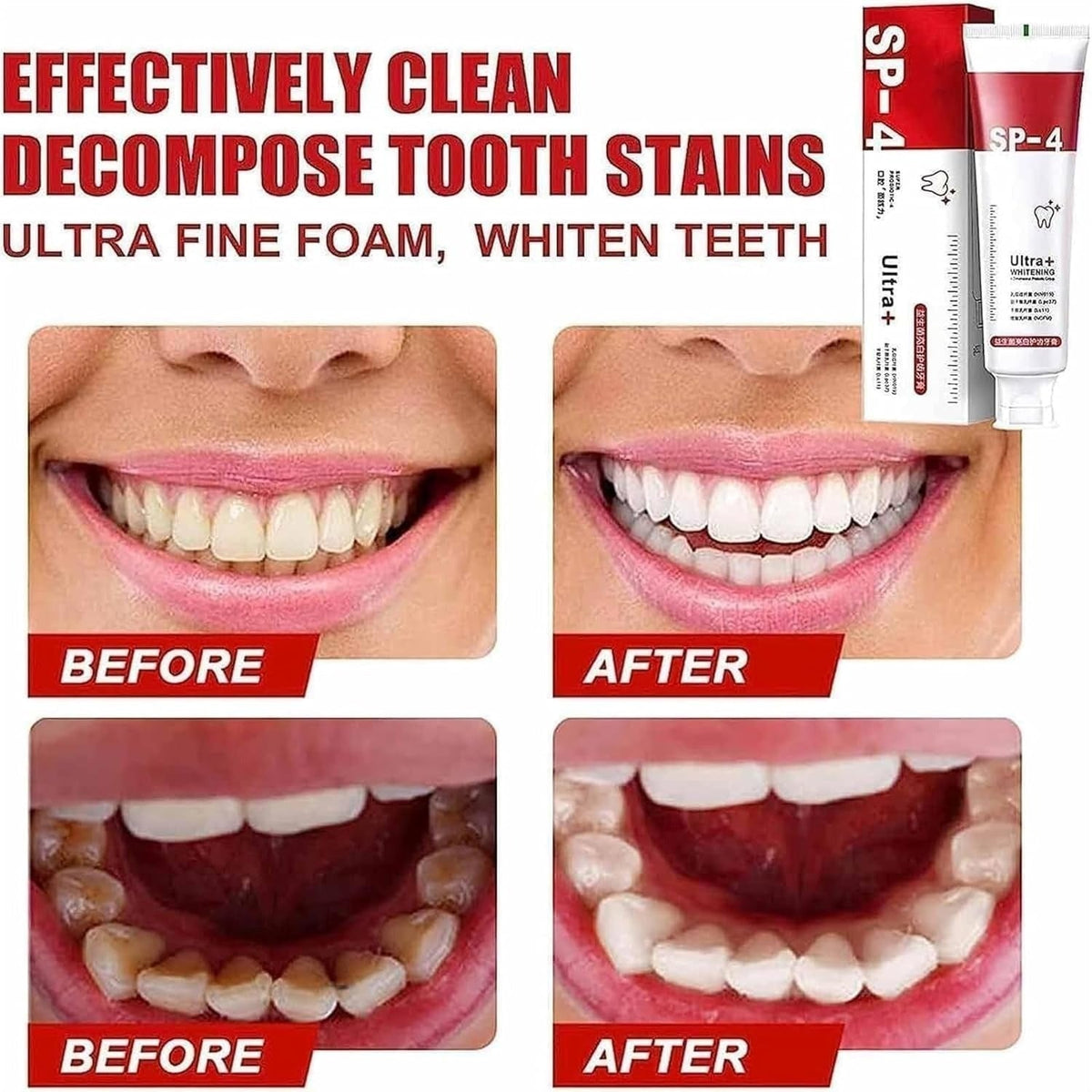 Yayashi SP-4 Probiotic Ultra Whitening Toothpaste & Intensive Stain Remover