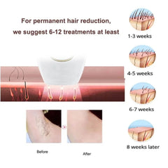 IPL Laser Hair Removal Handset System with Razor & Safety Glasses